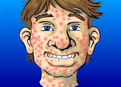 Traitement de l acnee